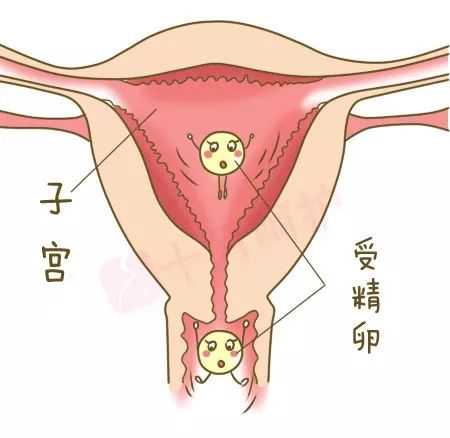 广西代怀孕产子网，2023广西壮族自治区妇幼保健院做三代试管婴儿生双胞胎费