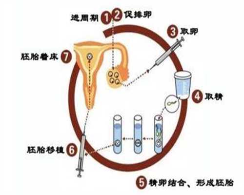 女性输卵管有积水应该怎么办