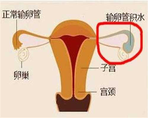 卵巢位置高怎么怀孕
